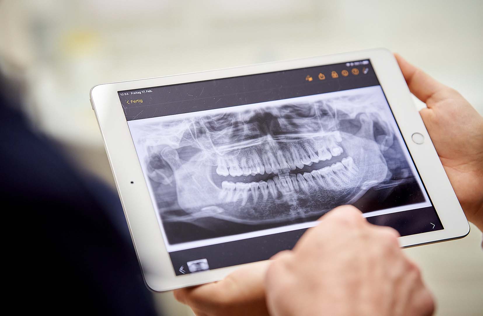 Zwei Hände halten ein Ipad, auf dem ein Röntgenbild der Zahnarztpraxis Holz in Wetzlar zu sehen ist.